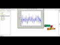 Detection of Epileptic Seizure from EEG Signal Using Discrete Wavelet Transform and J48 Classifier