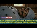Gara Gara Berhijab Tubuh Seorang Wanita Muda Dipenuhi Ratusan Lintah