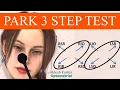 Park 3-Step Test Bielschowsky Head Tilt Test Parks 3-Step Test Procedure