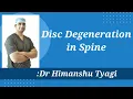 Download Lagu Disc Degeneration in spine