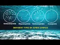 Semen analysis Samples - OLIGOZOOSPERMIA ASTHENOZOOSPERMIA TERATOZOOSPERMIA SPERM COUNT