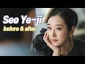 Seo Ye-ji before and after