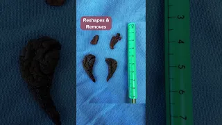 Female Intimate Surgeries With Dr Saldaña Gynecologist Surgery Womenhealth Vaginalhealth 