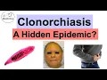 Download Lagu Clonorchiasis (Chinese Liver Fluke) | Infection, Signs \u0026 Symptoms, Diagnosis, Treatment