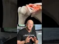 Shoulder Separation AC Joint Dislocation