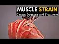 From Pain to Gain Exploring Muscle Strain Treatment for a Speedy Recovery