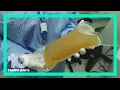 Denied from donating plasma Florida lawmaker s experience highlights dehumanizing FDA policy