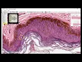 Keratinized stratified squamous epithelium