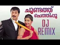 Download Lagu Chundathu Chethippoo | DJ Remix | Chronic Bachelor | Mammootty | Mukesh | Rambha | Bhavana | Ashokan