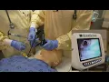 Intubation simulation