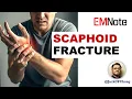 Download Lagu Scaphoid Fracture: The Hidden Wrist Injury You Can't Ignore!
