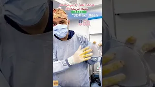 شبكة 3D مخصصة لجراحة الفتق الاربي بالمنظار 