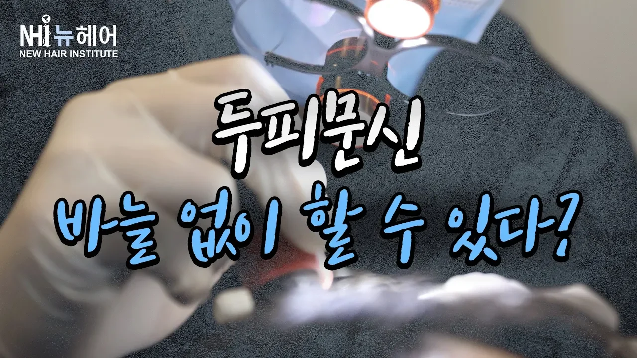 (JPN) 두피문신, 바늘없이도 할 수 있다? - 뉴헤어 I 두피문신