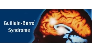 متلازمة غيلان باريه دندنها