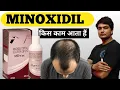 morr 5 solution morr solution minoxidil 5 minoxidil solution uses in hindi