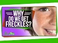 Why Do We Get Freckles