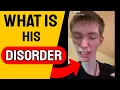 What disorder does Daddy Long Neck have