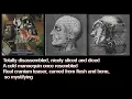 Carcass "Corporal Jigsore Quandary" (1991) Lyrics Video