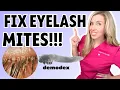3 Drugstore Products To Fix Eyelash Mites Demodex Explained by The Budget Derm