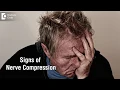 Are numbness or pin prick sensation signs of nerve compression - Dr Mohan M R