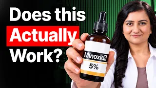 Minoxidil Explained: Hair Regrowth, Side Effects & What Happens If You STOP!