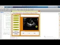 Matlab Code Steganography Using Image Processing