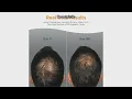 Viviscal Men s Hair Growth Supplements Review Does Collagen Complex Deliver Thicker Fuller Hair
