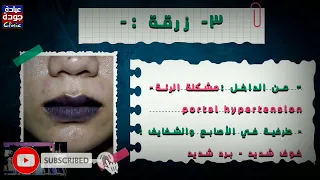 الوجه الأزرق دكتور جودة محمد عواد دكتور جودة محمد عواد 