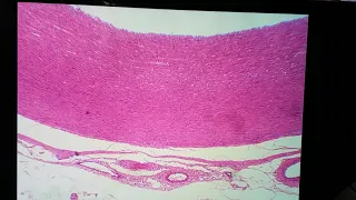 Histologia de artérias de grande e médio calibre
