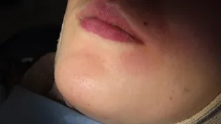 canted occlusal plane correction