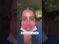 Download Lagu Urfi Javed’s Face Shockingly Swollen – Fans Left Concerned 😢 #urfijaved #shortvideo #shorts