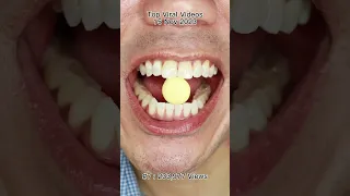 The Most Satisfying Chocolate & Candy ASMR Compilation