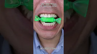 The Most Satisfying Chocolate & Candy ASMR Compilation