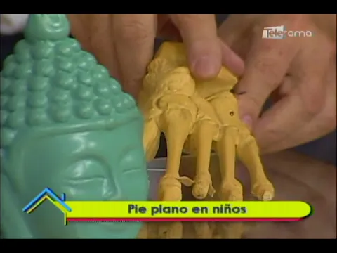 Pie plano en niños