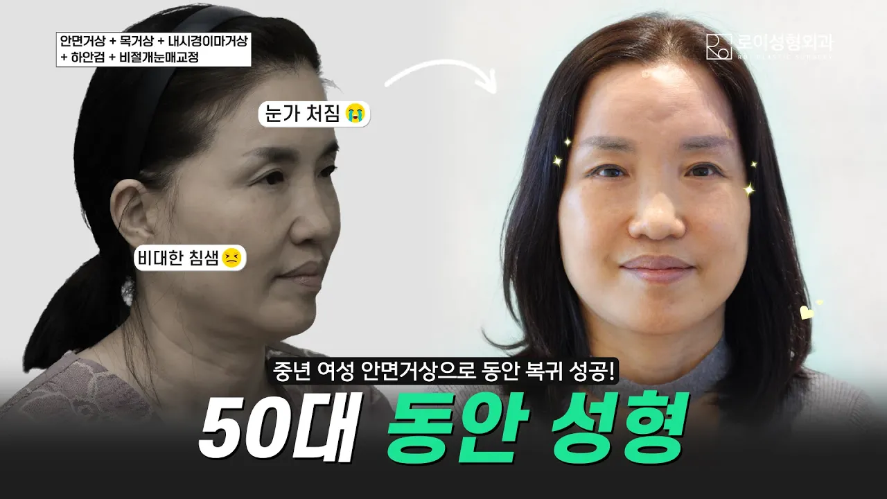 예전엔 김태리 닮았다는 소리도… 58세 그녀의 리즈 되찾기 프로젝트