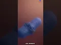 How drugs are absorbed in the body pill dissolve