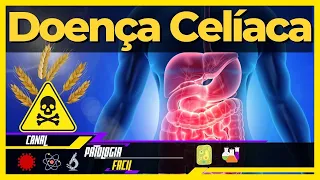 O que é Doença Celíaca? [Sintomas, Fisiopatologia, Tratamento e Diagnóstico]