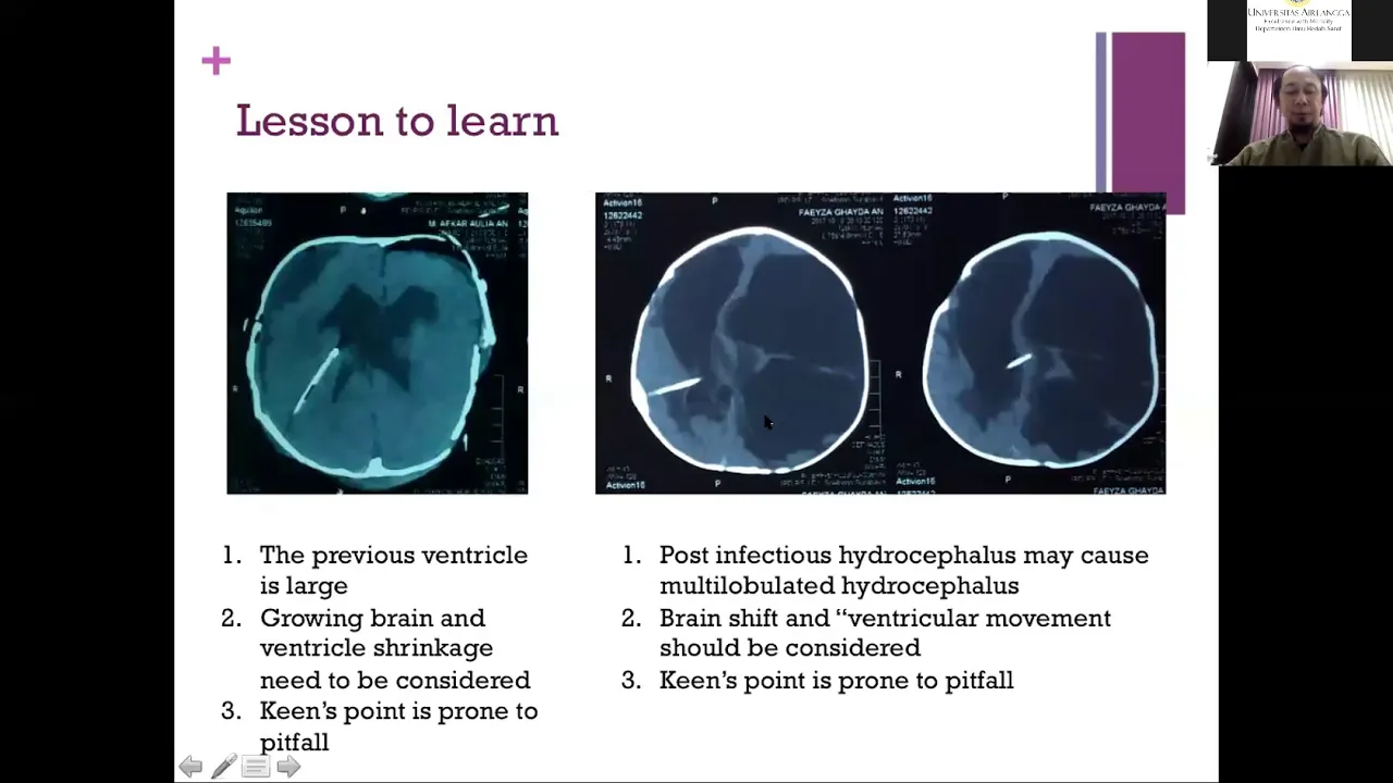 Webinar Diagnosis dan Penatalaksanaan Nyeri Berdasarkan Klasifikasi. 