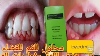 طريقة استعمال بيتادين مطهر للفم وعلاج التهاب الفم واللثة ومضاد للفطريات والبكتيريا و الجراثيم دندنها