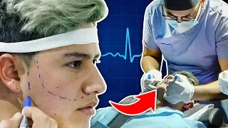 Así fue mi operación de transplante de barba 🧔🏽