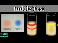 Indole Test Tryptophanase Test