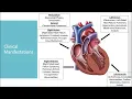 Mass Effect Adult Primary Cardiac Tumors
