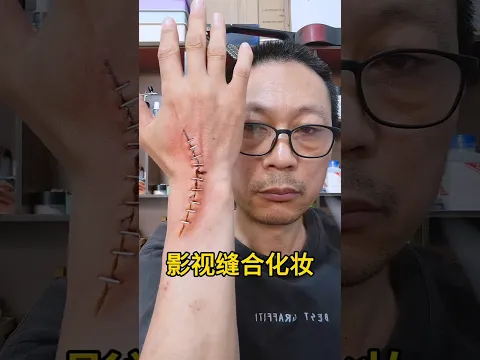 😱 Dad Removed 50 Stitches in 1 Minute… But They Were FAKE?! 🤯