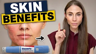 Can Ozempic & Wegovy Improve Your Skin? Skin Benefits of GLP-1s