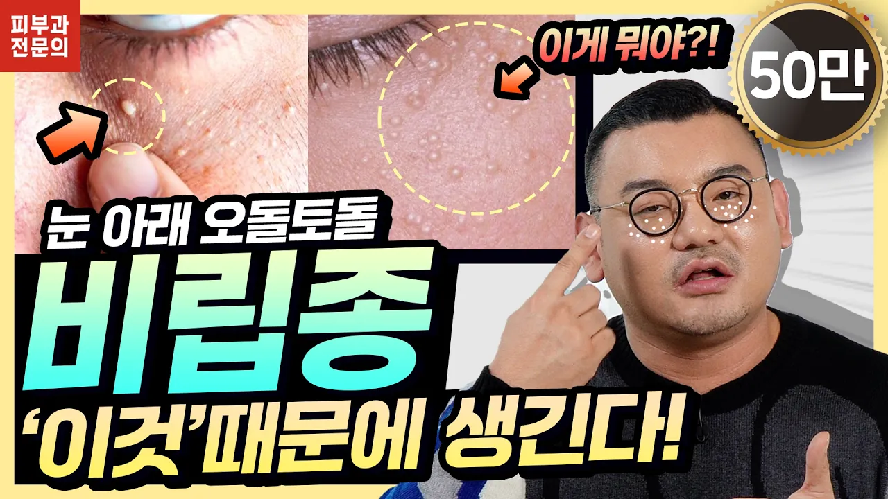 目の下の稗粒腫はなぜできる？皮膚科医が教える稗粒腫の予防法4つ（すっきりした目元のために）