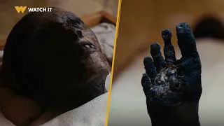 أم الدنيا   مومياء الملك توت عنخ آمون اتفحمت ووصلت لحالة سيئة للسبب ده  دندنها