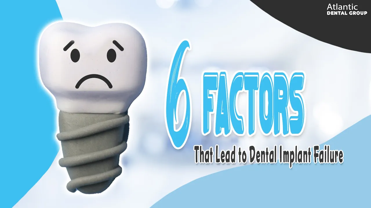 Outline Video 6 Factors that Lead to Dental Implant Failure