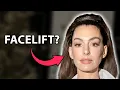 Truth Behind Anne Hathaway s Look Plastic Surgeon Reacts