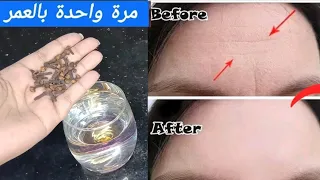 اخلطي القرنفل والماء وستختفي التجاعيد وكأنك في العشرين من عمرك! 🌟 قناع القرنفل لبشرة متوهجة بيضاء