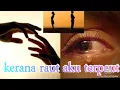 Kerana Raut Aku Terpaut